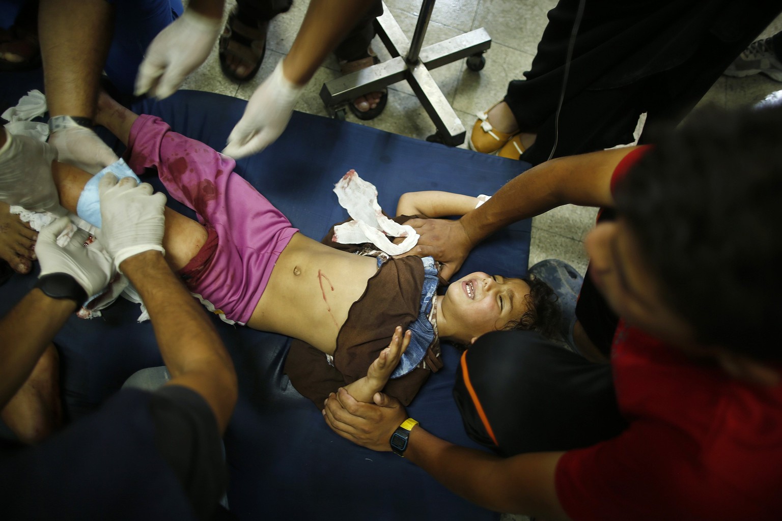 Palästinensisches Mädchen wird in einem Spital in Gaza versorgt.