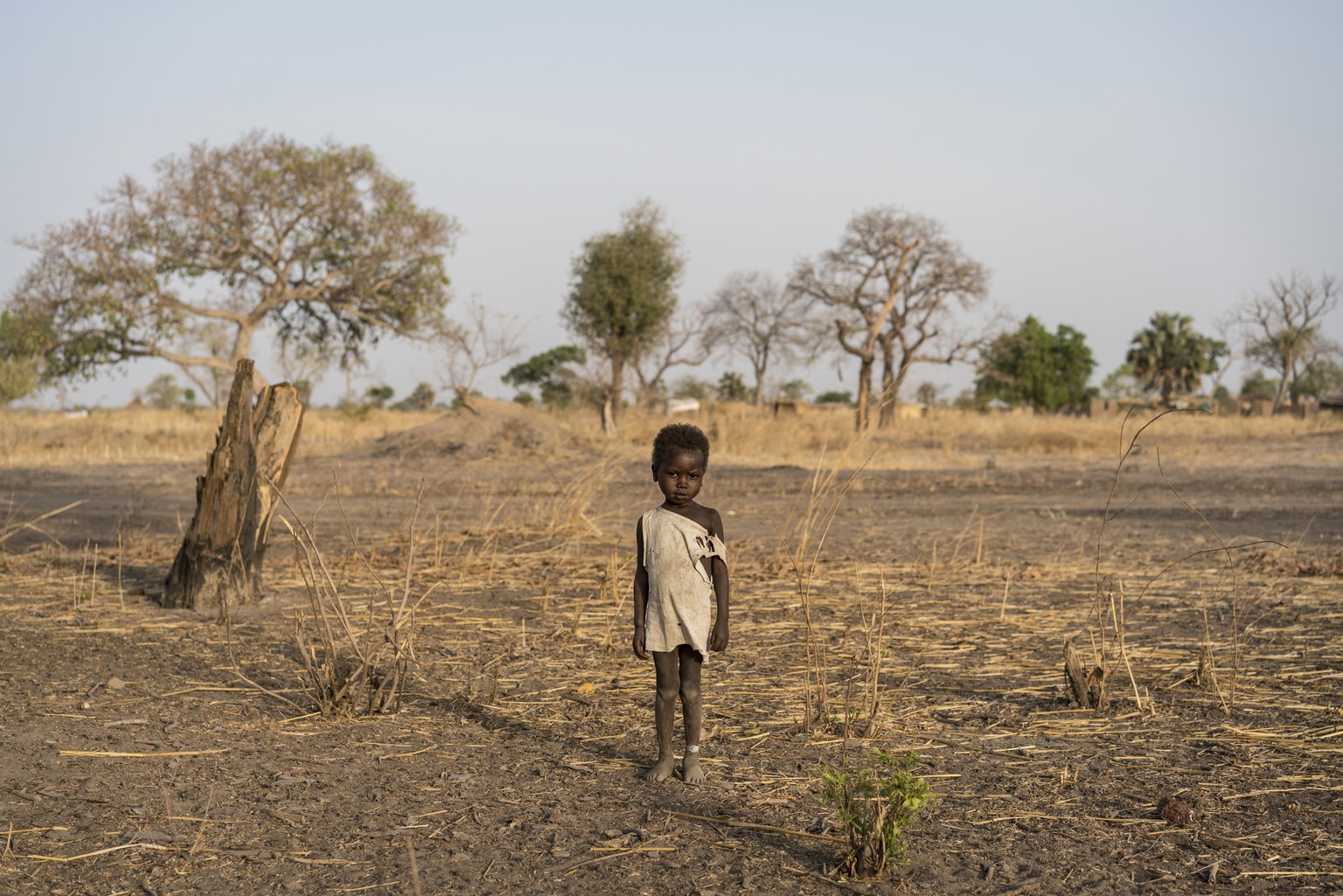 In this photo taken Friday, March 10, 2017, a boy named Giel wears a small white bracelet on his ankle indicating that he&#039;s just finished treatment at an outpatient therapeutic program, as he sta ...