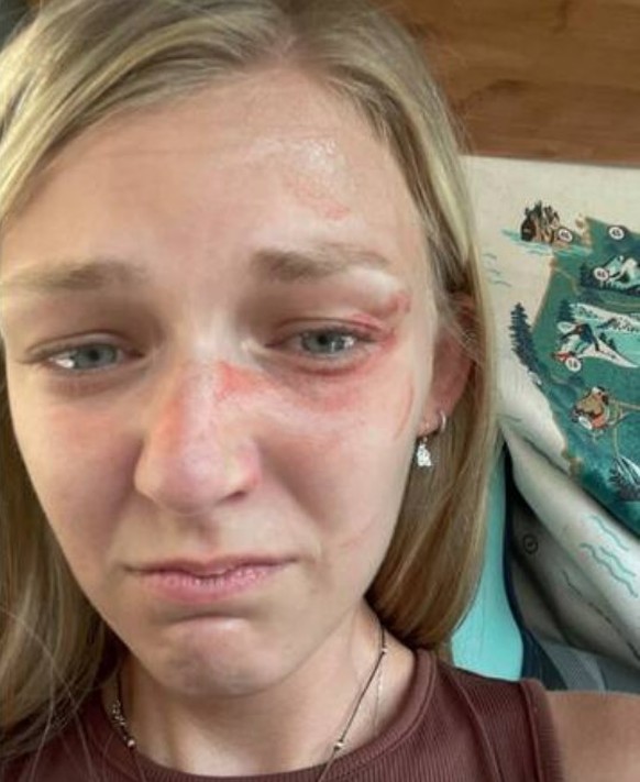 Gabby Petito dokumentiert ihre Verletzungen mit Tränen gefüllten Augen.