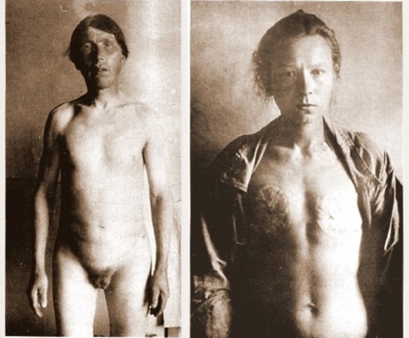 Ein männlicher Skopze ohne Hoden und Penis und eine weibliche mit abgeschnittenen Brüsten.