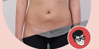 Die DeepNude-App zieht Frauen aus – ohne Einwilligung der Betroffenen