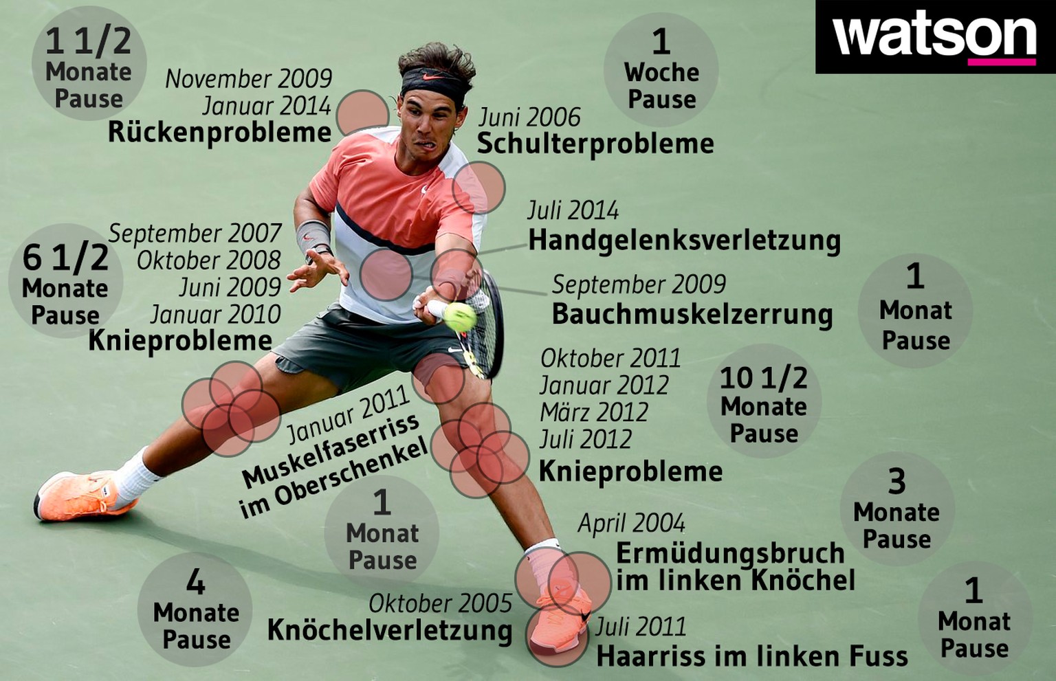 Die unendliche Verletzungsgeschichte von Rafael Nadal. &gt;&gt; Mobile User klicken hier.