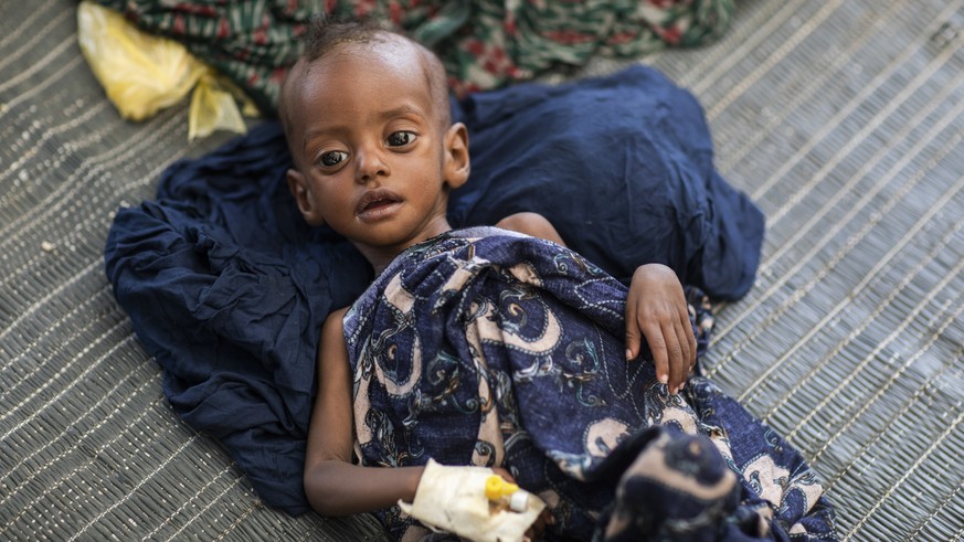 In this photo released by UNICEF, severely malnourished baby Mariyem lies in a temporary stabilisation center in the district of Afdera in the Afar region of Ethiopia Wednesday, May 11, 2022. Accordin ...