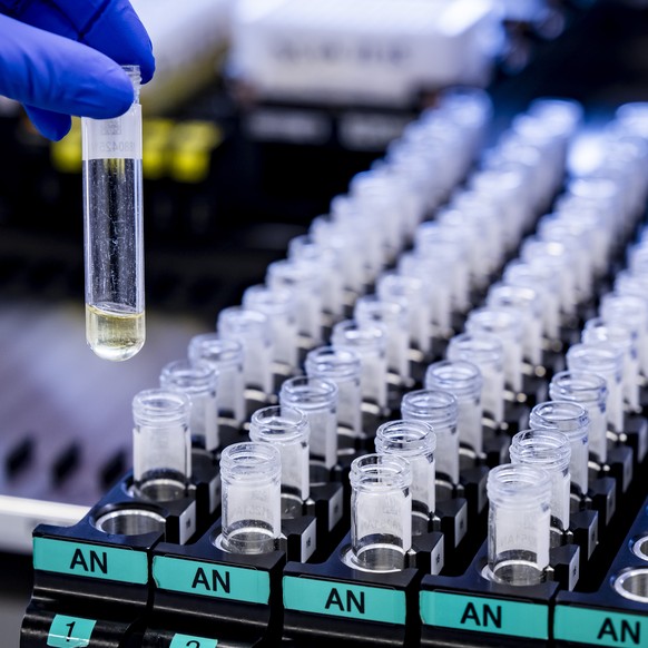 Un collaborateur du LAD, le Laboratoire suisse d'Analyse du Dopage, analyse des echantillons contenant de l'urine dans le laboratoire antidopage, une antenne du Chuv le jeudi 4 decembre 2025 ...