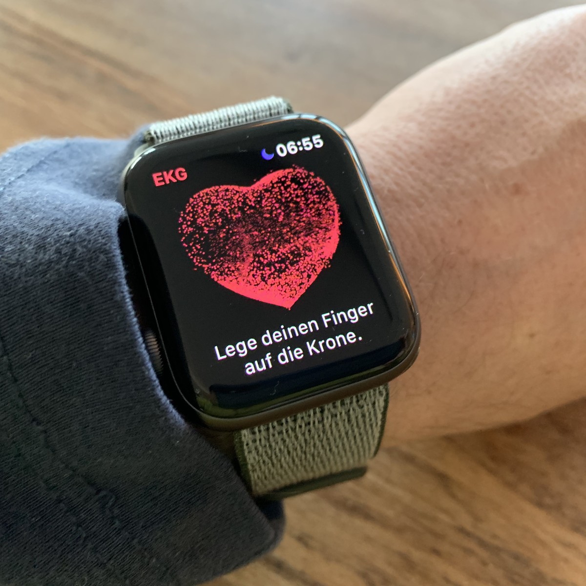 Apple series 5 2025 ekg