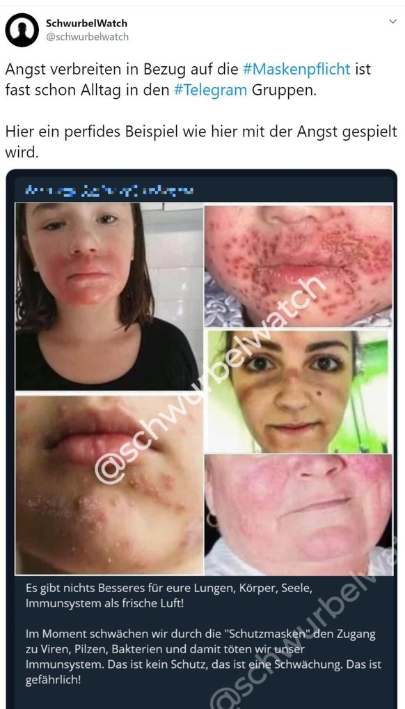 Die von Verschwörungstheoretikern geteilten Fotos zeigen Menschen mit Herpes oder Windpocken und, besonders fies, eine italienische Krankenschwester, die nach 13 Stunden Dienst ihre Schutzkleidung abg ...