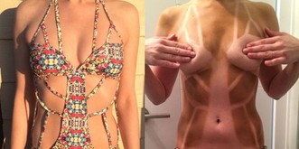 Ups! Diese Bräunungs-Fails solltest du diesen Sommer besser vermeiden