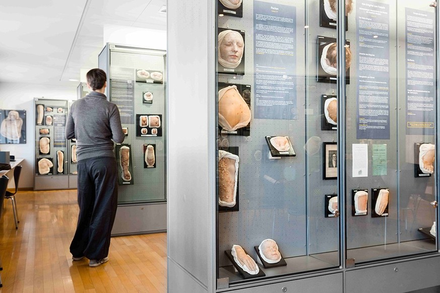 Moulagenmuseum Zürich Rauszeit Museum Schweiz