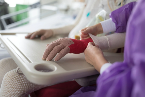 Eine Physiotherapeutin macht Übungen mit einer brandverletzten Person: Brandopfer haben oft eine wochen- bis monatelange Rehabilitionsphase vor sich.