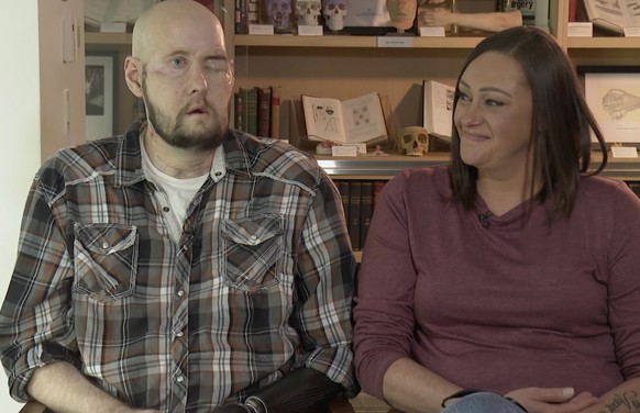 Aaron James speaks during an interview, accompanied by his wife, Meagan, in New York on Oct. 23, 2023. ?In his mind and his heart, it?s him _ so I didn?t care that, you know, he didn?t have a nose. Bu ...