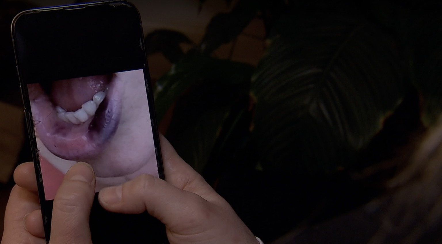 Gefälschte Produkte sind auch in nichtmedizinischen Schönheitssalons verbreitet.