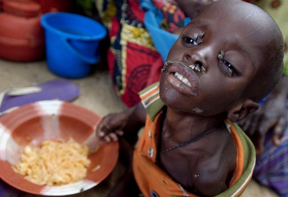 Ein hungerndes Kind in Niger. Die Bevölkerung auf dem schwarzen Kontinent wird sich in den nächsten 35 Jahren verdoppeln.&nbsp;