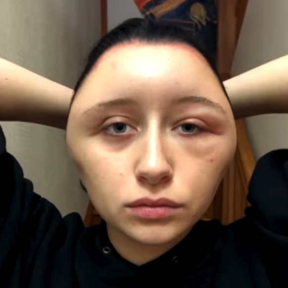 Das ist Estelle, 19, eine Studentin aus Vitry-sur-Seine, Frankreich. 
Haare färben fail