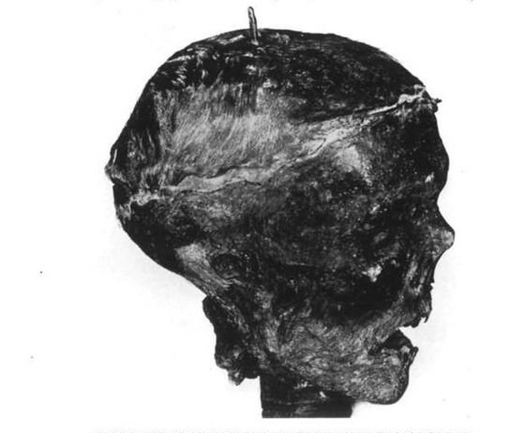 In Pearsons Bericht heisst es zum Schädel: «Der Wilkinson Schädel im rechten Profil zeigt den Eichenpfahl und die korrodierte Spitze des Eisenzapfens sowie die Aufbruchstelle an der Schädeldecke, die  ...