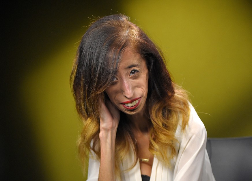 n this Monday, Aug. 24, 2015 photo, Lizzie Velasquez poses for a photo at the Associated Press bureau, in Los Angeles. Velasquez, an anti-bullying activist, is the subject of the documentary film A B ...