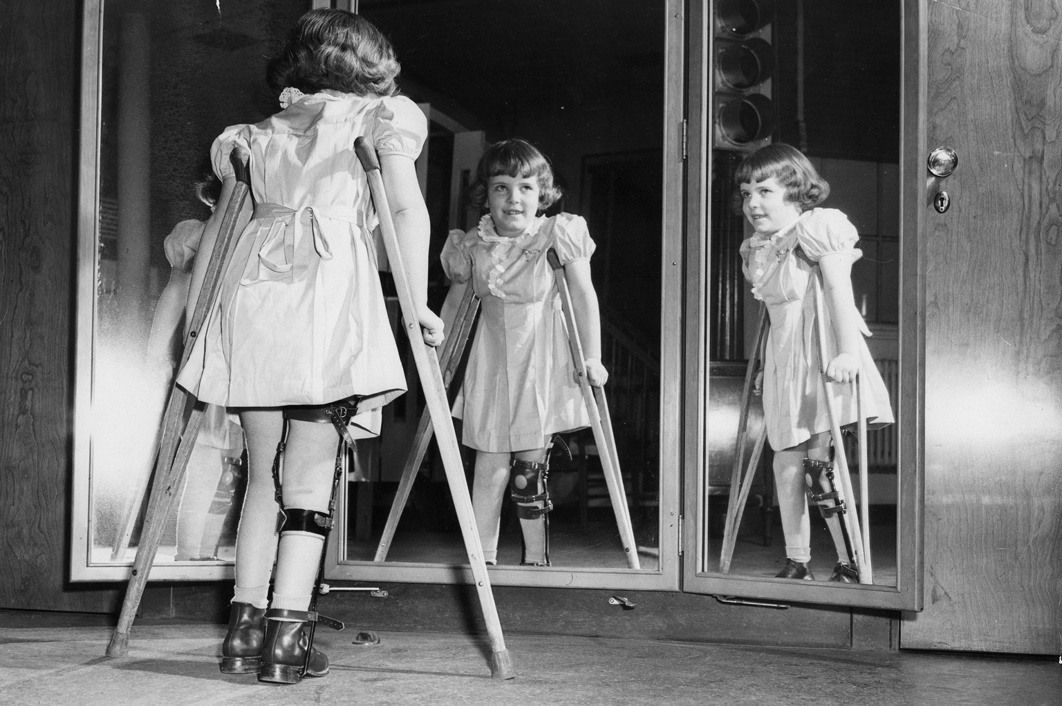 Many people infected with polio don&#039;t show any symptoms. Some become temporarily paralyzed; for others, it&#039;s permanent. In 1952, the polio epidemic reached a peak in U.S.: almost 58,000 repo ...