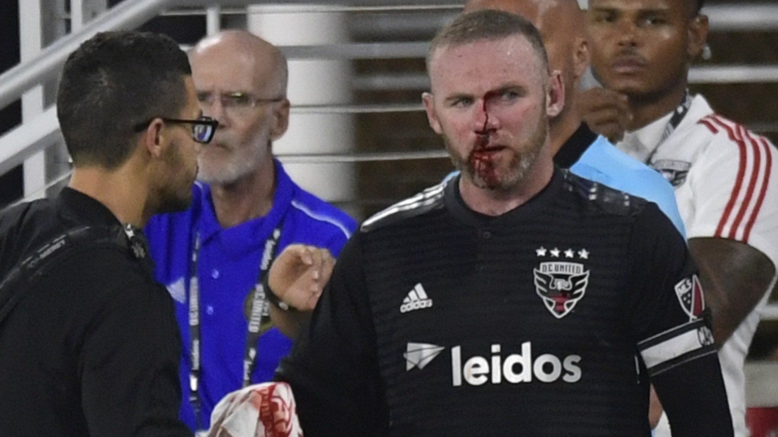 D.C. United forward Wayne Rooney (9) is assisted on the sideline after getting injured during the second half of an MLS soccer match against the Colorado Rapids in Washington, Saturday, July 28, 2018. ...