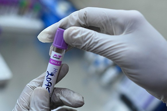 epa12935451 A laboratory staff holds a blood sample in a labeled tube for HIV testing and treatment at antiretroviral therapy (ART) centres are seen at a laboratory facility in Karachi, Pakistan, 29 A ...