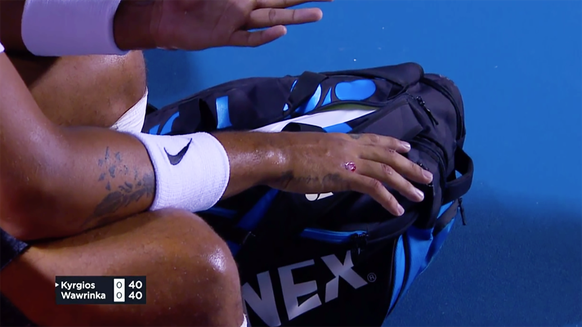 Die aufgeschürfte Hand von Kyrgios.