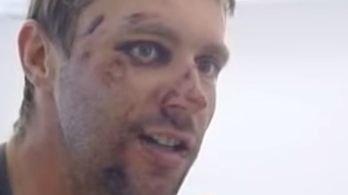 Jens-Voigt-st-rzt-f-rchterlich-und-gibt-drei-Tage-sp-ter-ein-obercooles-Interview
