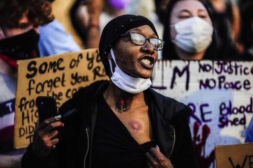 epaselect epa08626029 A protestor shows off a wound during a third night of unrest in the wake of the shooting of Jacob Blake by police officers, in Kenosha, Wisconsin, USA, 25 August 2020. According  ...