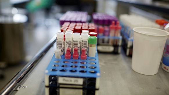 ARCHIV -- ZUM ZUKUENFTIG ERGAENZENDEN HEPATITIS E TEST BEI SPENDERBLUT, STELLEN WIR IHNEN AM MITTWOCH, 27. JUNI 2018, FOLGENDES BILDMATERIAL ZUR VERFUEGUNG -- Patientenroehrchen warten waehrend der Du ...