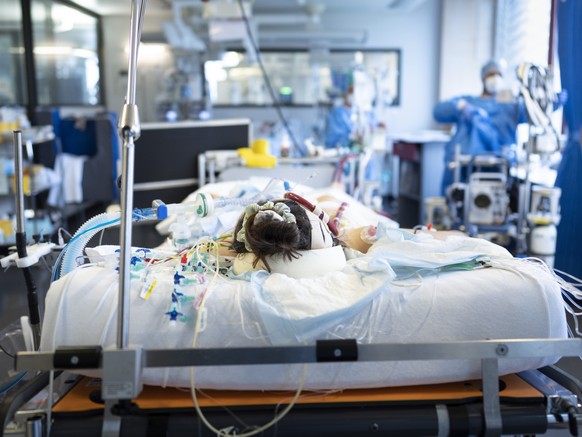 ZU COVID-19-PATIEN*INNEN AUF DER INTENSIVSTATION DES ZUERCHER STADTSPITALS TRIEMLI UND DEREN BEHANDLUNG MIT EINEM ECMO STELLEN WIR IHNEN FOLGENDES NEUES BILD ZUR VERFUEGUNG. WEITERE BILDER FINDEN SIE  ...