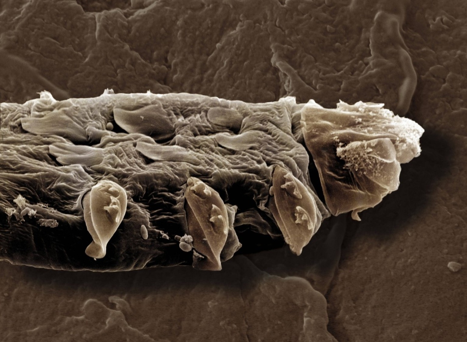 Haarbalgmilbe (Demodex folliculorum).
