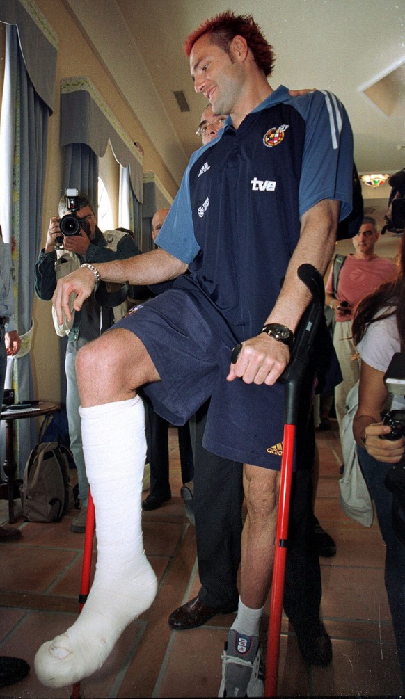 Ganz bitter verlief es für den ehemaligen spanischen Nationaltorhüter Santiago Cañizares. Der damalige Valencia-Goalie wollte sich im Vorfeld der WM 2002 die Haare aus dem Gesicht entfernen. Doch fiel ...