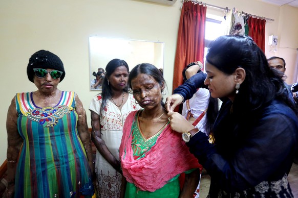 epa05197710 Acid attack survivors get ready backstage before walking the ramp as a display of courage during an event organized by an NGO ahead of the International Women&#039;s Day,Bhopal, India, 06  ...