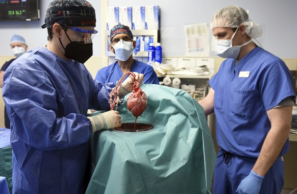 FILE - In this photo provided by the University of Maryland School of Medicine, members of the surgical team show the pig heart for transplant into patient David Bennett in Baltimore on Friday, Jan. 7 ...