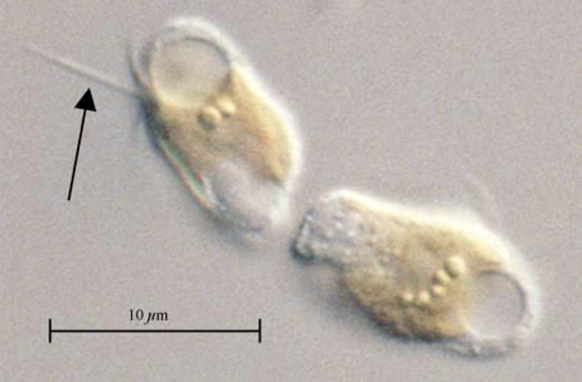 Prymnesium parvum, einzellige Mikroalge, auch Goldalge genannt.