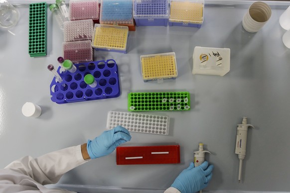 Biochemical researcher Tiziana Alberio works on sample of saliva at the Insubria university department of biomedical science and research in Busto Arsizio, Italy, Friday, Oct. 9, 2020. Researchers at  ...