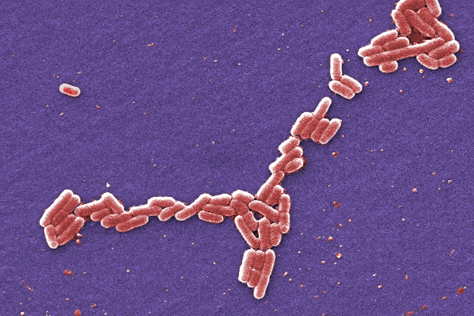 FILE - This colorized 2006 scanning electron microscope image made available by the Centers for Disease Control and Prevention shows E. coli bacteria of the O157:H7 strain that produces a powerful tox ...