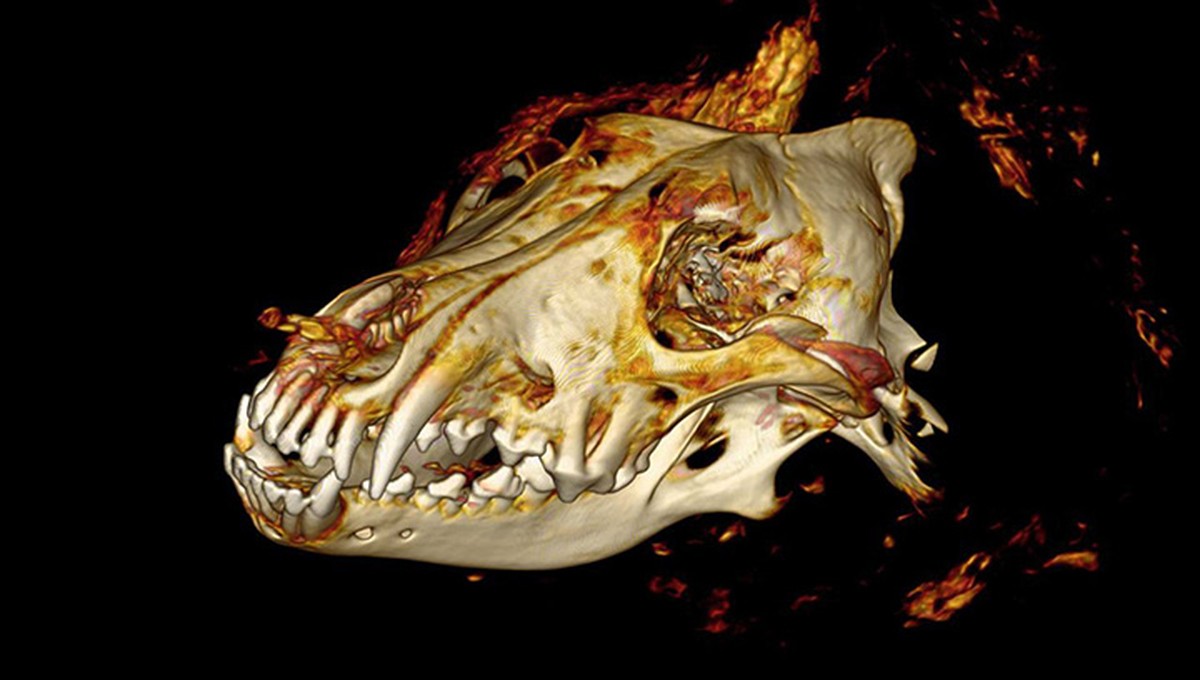 CT scan of the head