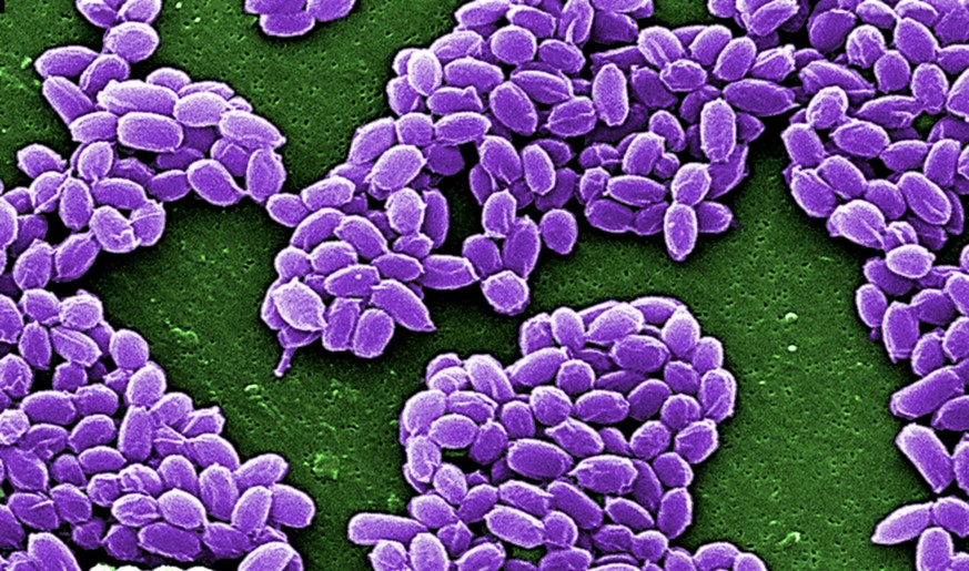 Potentiell unsterblich: Bakterien. Hier&nbsp;Bacillus anthracis, der Erreger des Milzbrandes.