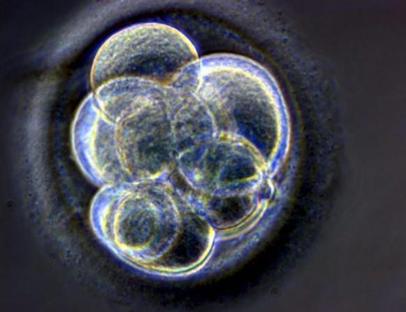 Am Anfang sind wir Zellen. Hier ein geklonter menschlicher Embryo (2005). Er hat die Grösse des Punktes hinter diesem Satz.