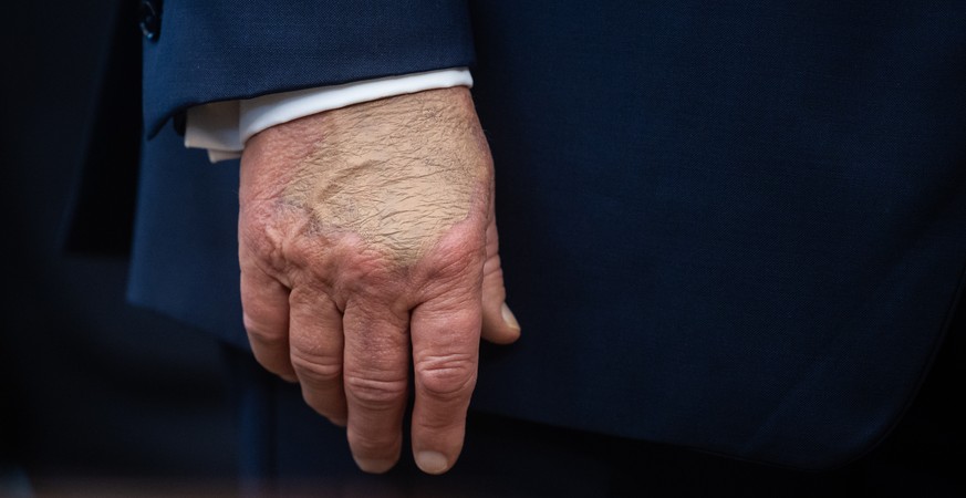 epa12417631 The right hand of US President Donald Trump is seen as he announces a drug-pricing deal with Pfizer in the Oval Office at the White House in Washington, DC, USA, 30 September 2025. EPA/FRA ...