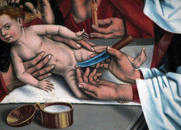 Beschneidung Jesu: Gemälde von Friedrich Herlin (1466).