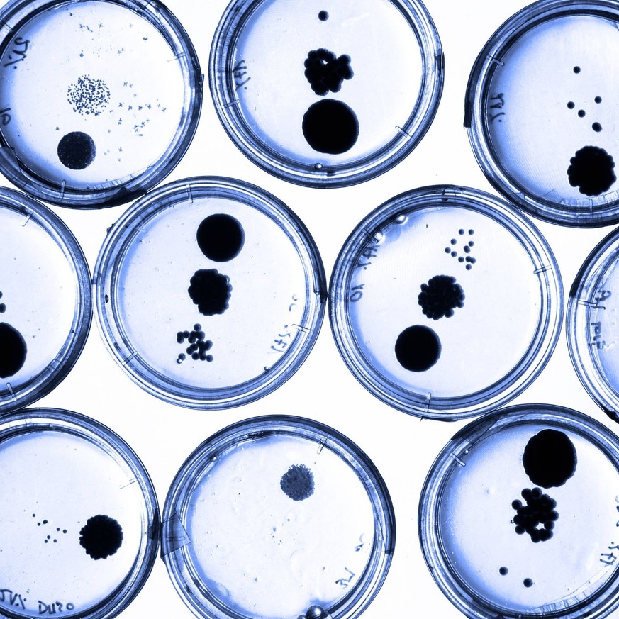 Growing Bacteria in Petri Dishes. Growing Bacteria in Petri Dishes on agar gel as a part of scientific experiment. Blue toned macro shot. Copyright: xZoonar.com/MatejxKastelicxMatejxKastelicx 7744861