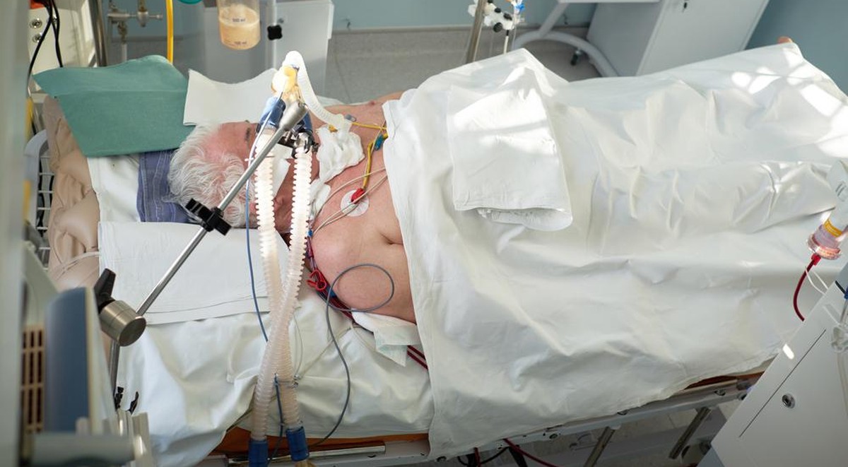 Koronavirus-Pandemie.Patienten mit einer Pneumonie des Coronavirus im kritischen Zustand. Intubierte Senior unter Beatmung im Koma in der Intensivstation.
