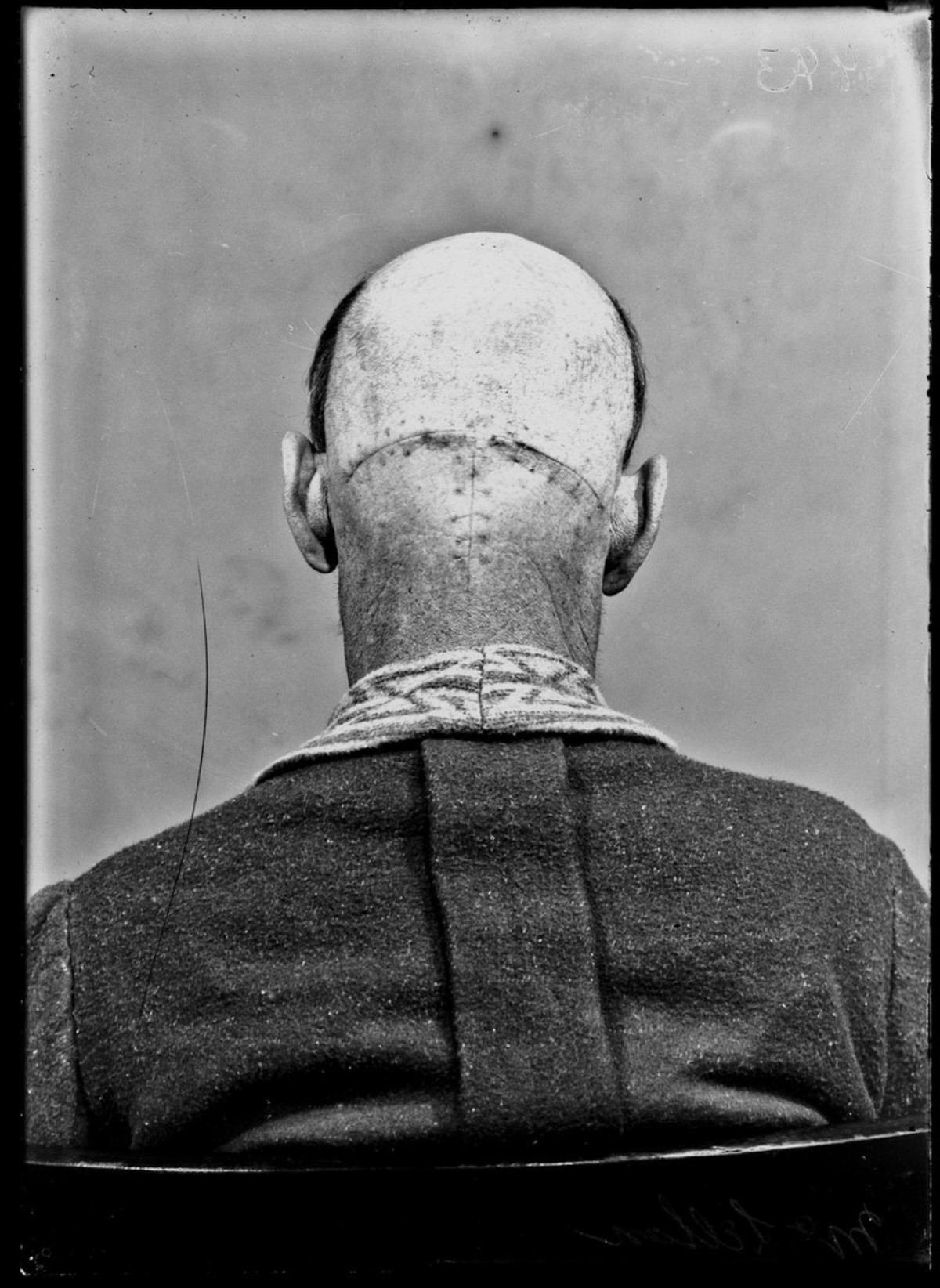 Dr. Crushing Brain Surgery

Yale University Library