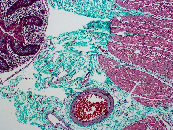 Dabei sieht so manches Gewebe unter dem Mikroskop ziemlich cool aus.