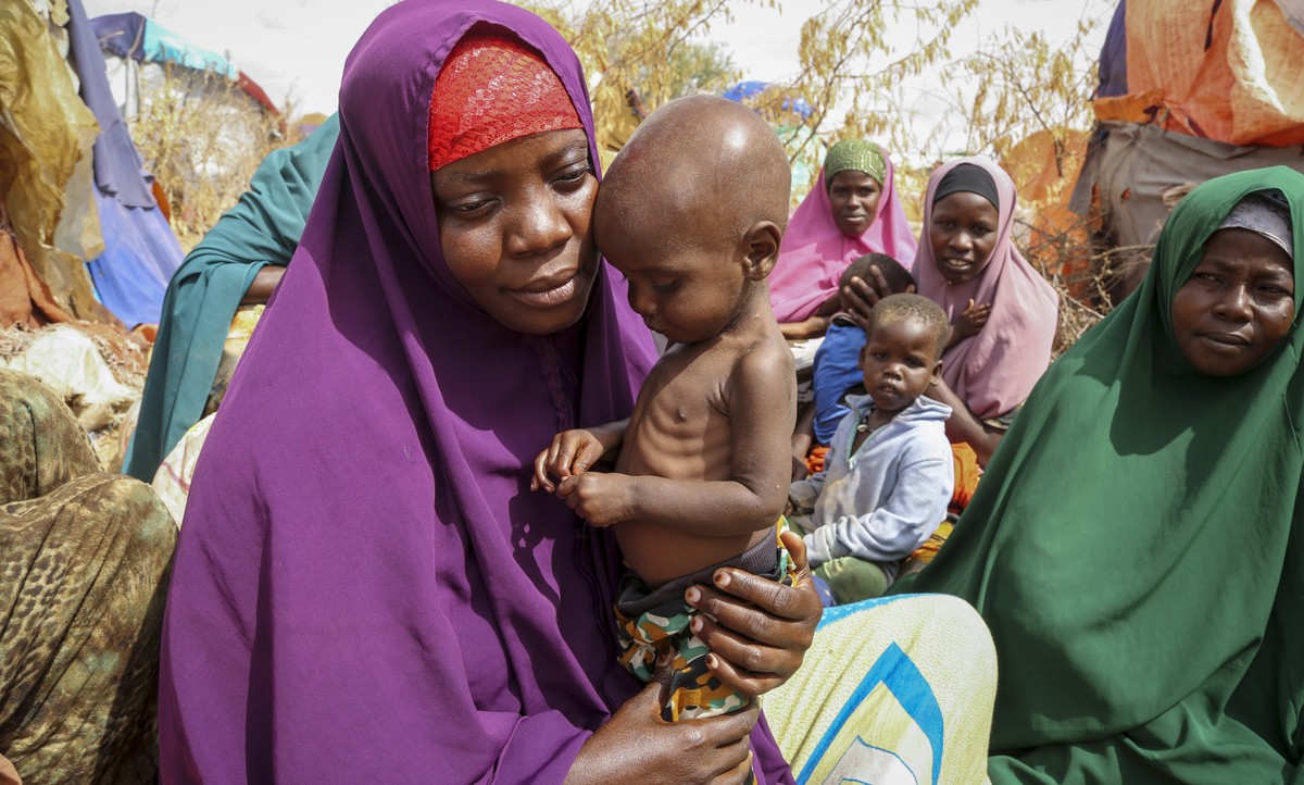 FILE - Nunay Mohamed, 25, who fled the drought-stricken Lower Shabelle area, holds her one-year old malnourished child at a makeshift camp for the displaced on the outskirts of Mogadishu, Somalia on J ...