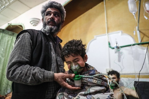 epa06565553 An affected child is treated after a gas attack on al-Shifunieh village, Eastern Ghouta, Syria, February 25, 2018 (issued February 26, 2018).  According to activists working in the...