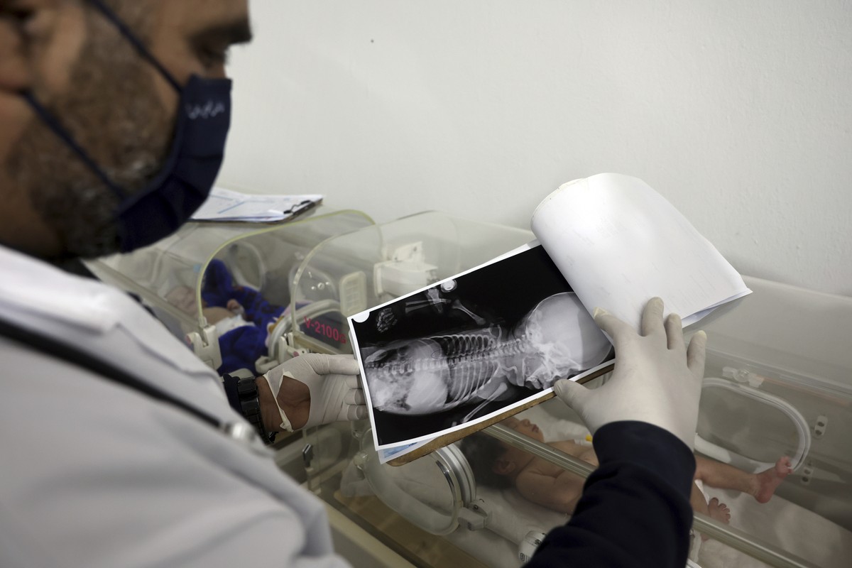 Doctor Hani Maarouf looks at an x-ray of a baby girl who was born under the rubble caused by an earthquake that hit Syria and Turkey, as she lays inside an incubator at a children's hospital in t ...
