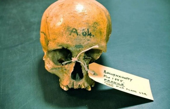 1855 gefunden:&nbsp;Der Schädel der Frau ist 5200 Jahre alt.&nbsp;