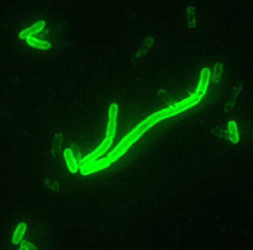 Erreger der Pest: Bakterium Yersinia pestis
https://commons.wikimedia.org/w/index.php?curid=11692164