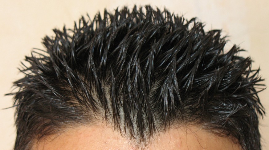 Spiky Hair: Igeli Frisur