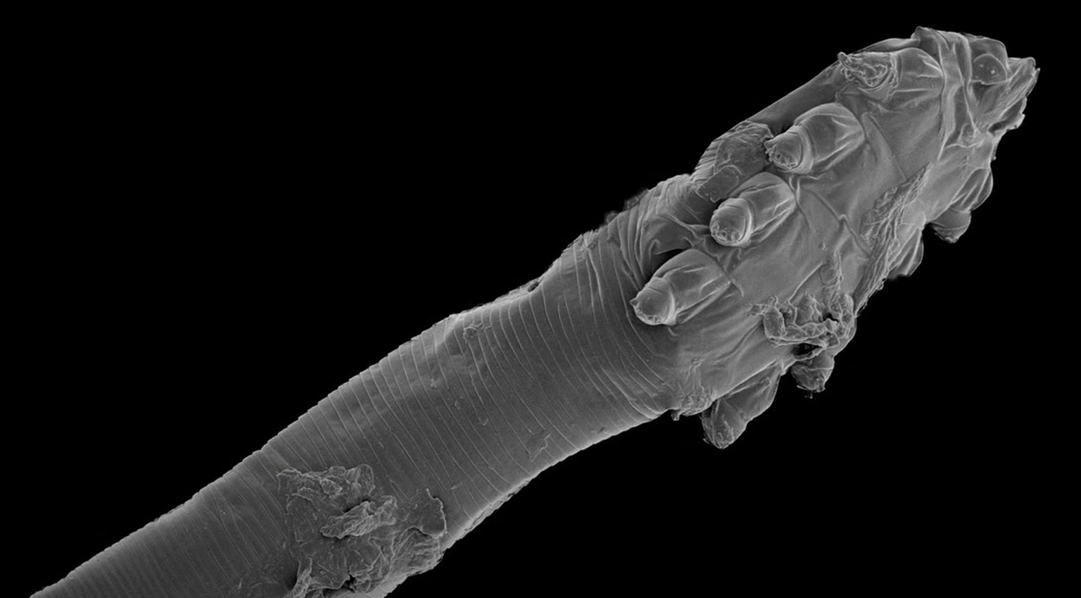 Haarbalgmilbe (Demodex folliculorum)
https://www.youtube.com/watch?v=YW2eGaUzq7E